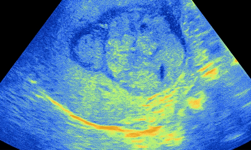 Liver