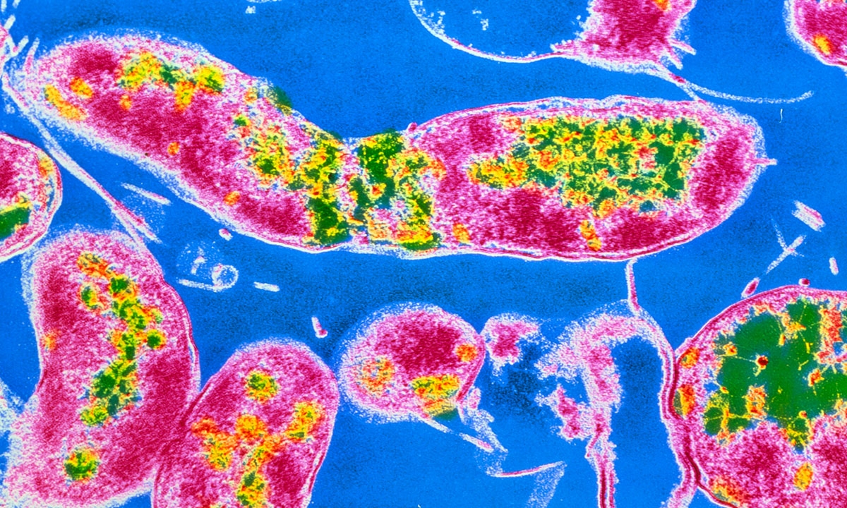 Low dose aspirin and h pylori asking for trouble 348
