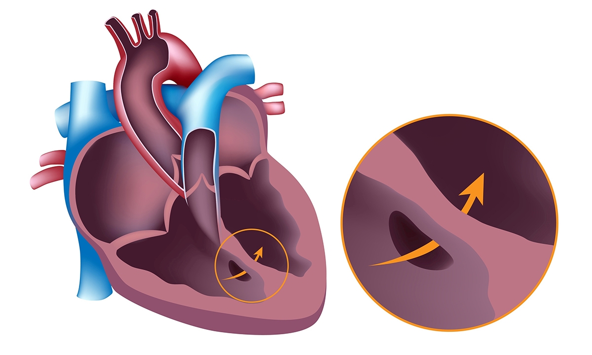 Mental health care for chd patients and families 192
