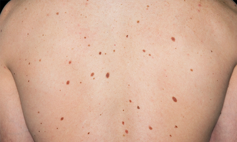Moles
