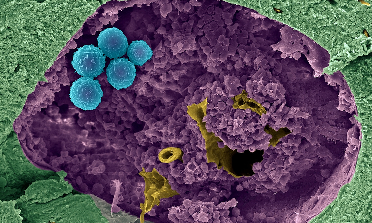 Moral maze around children as tissue donors - Featured Image
