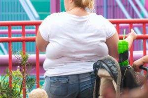 Cost not the point in bariatric surgery - Featured Image