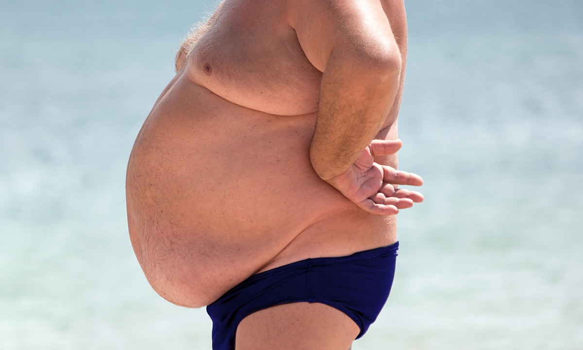 Obesity: we’re not even at first base - Featured Image