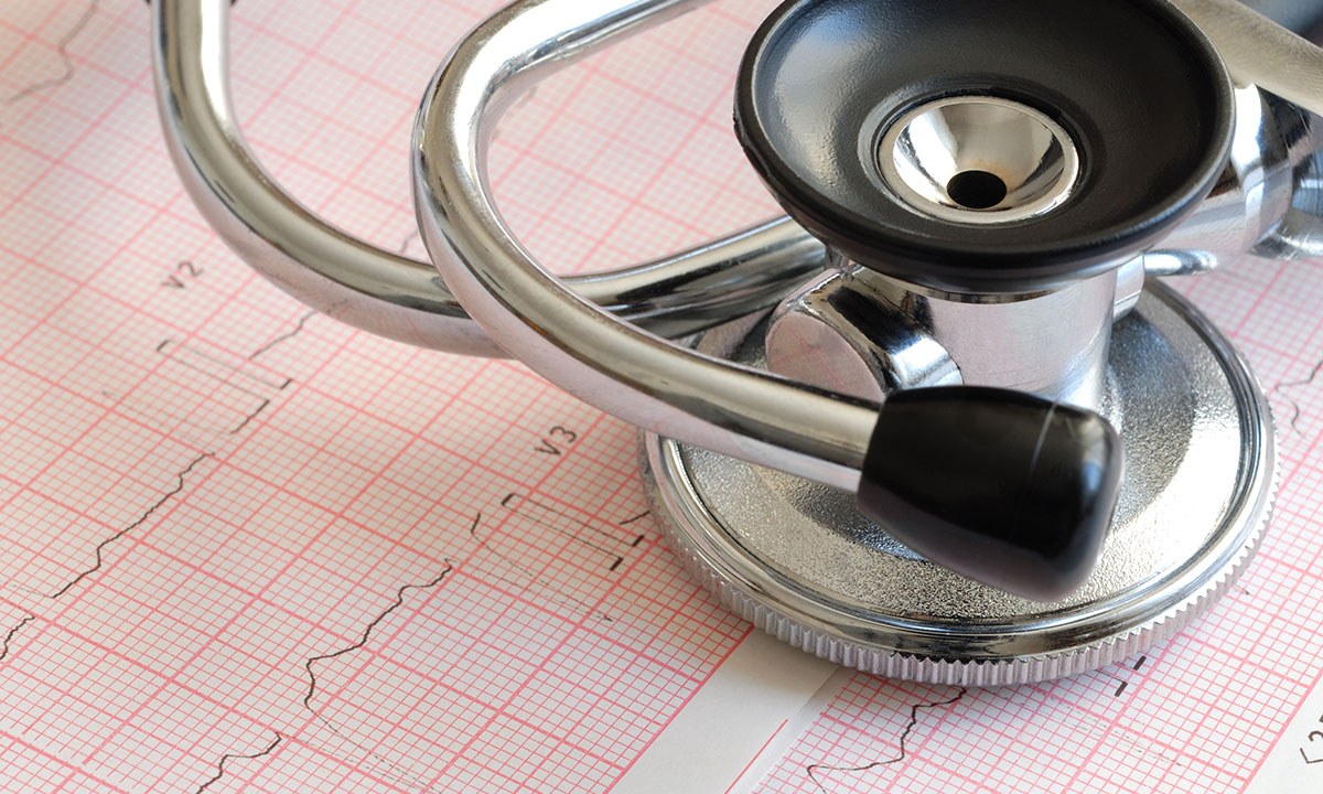 Opportunistic screening recommended for atrial fibrillation 893