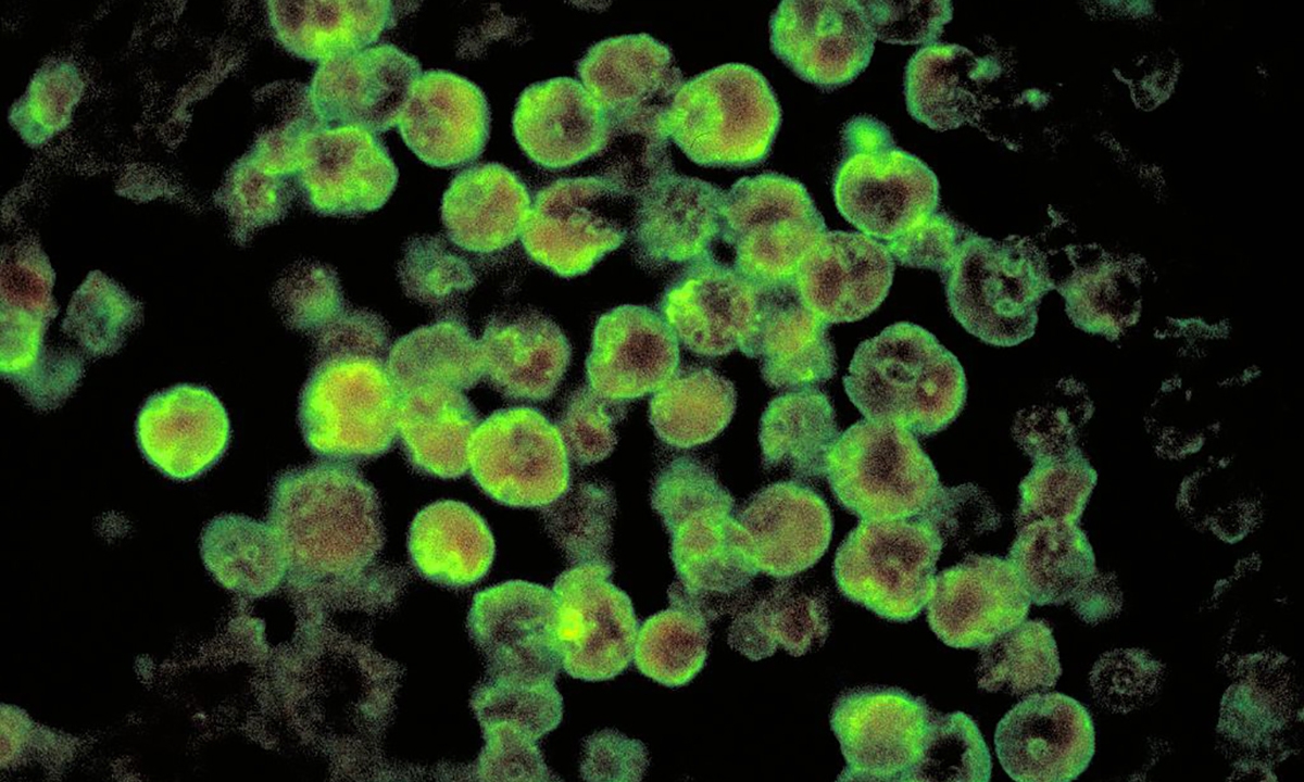 Primary prevention best ally against deadly meningitis lookalike - Featured Image