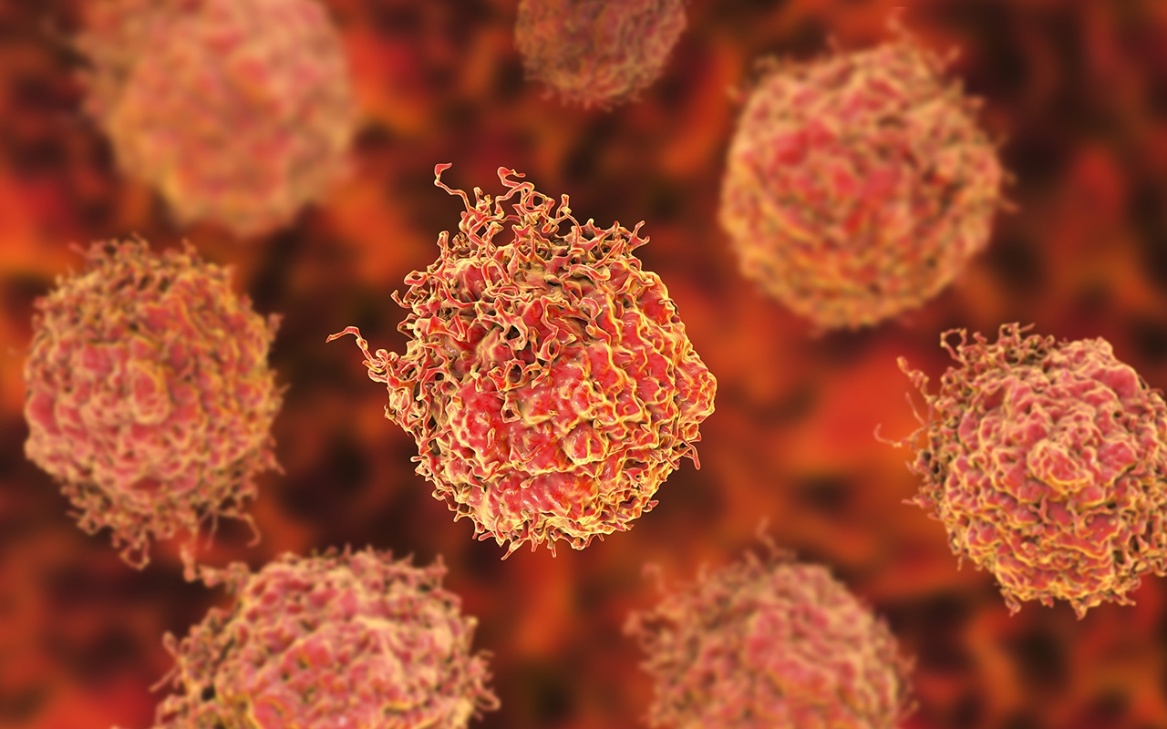 Prostate cancer screening guidelines need urgent update - Featured Image