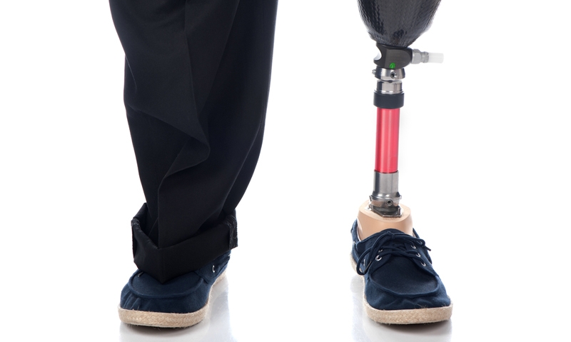 Prosthetic