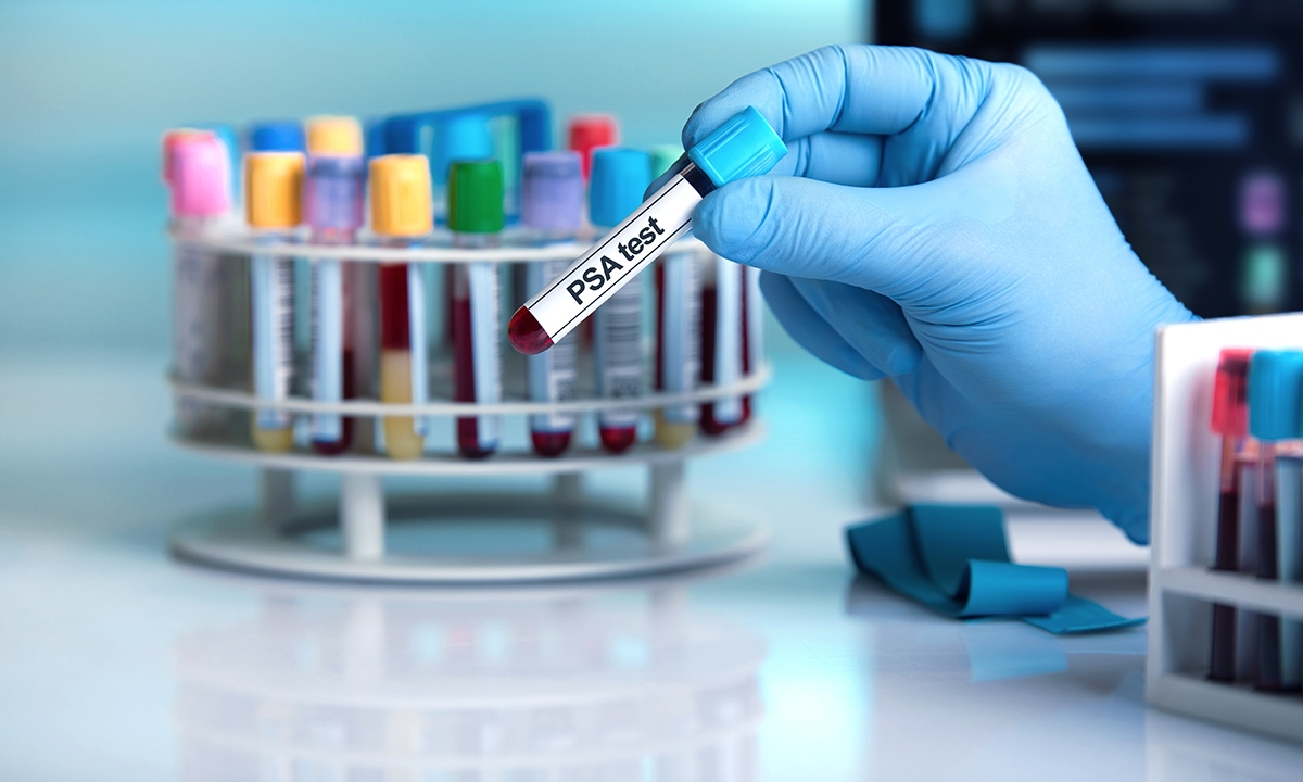 Psa screening for asymptomatic men is the jury in yet 359