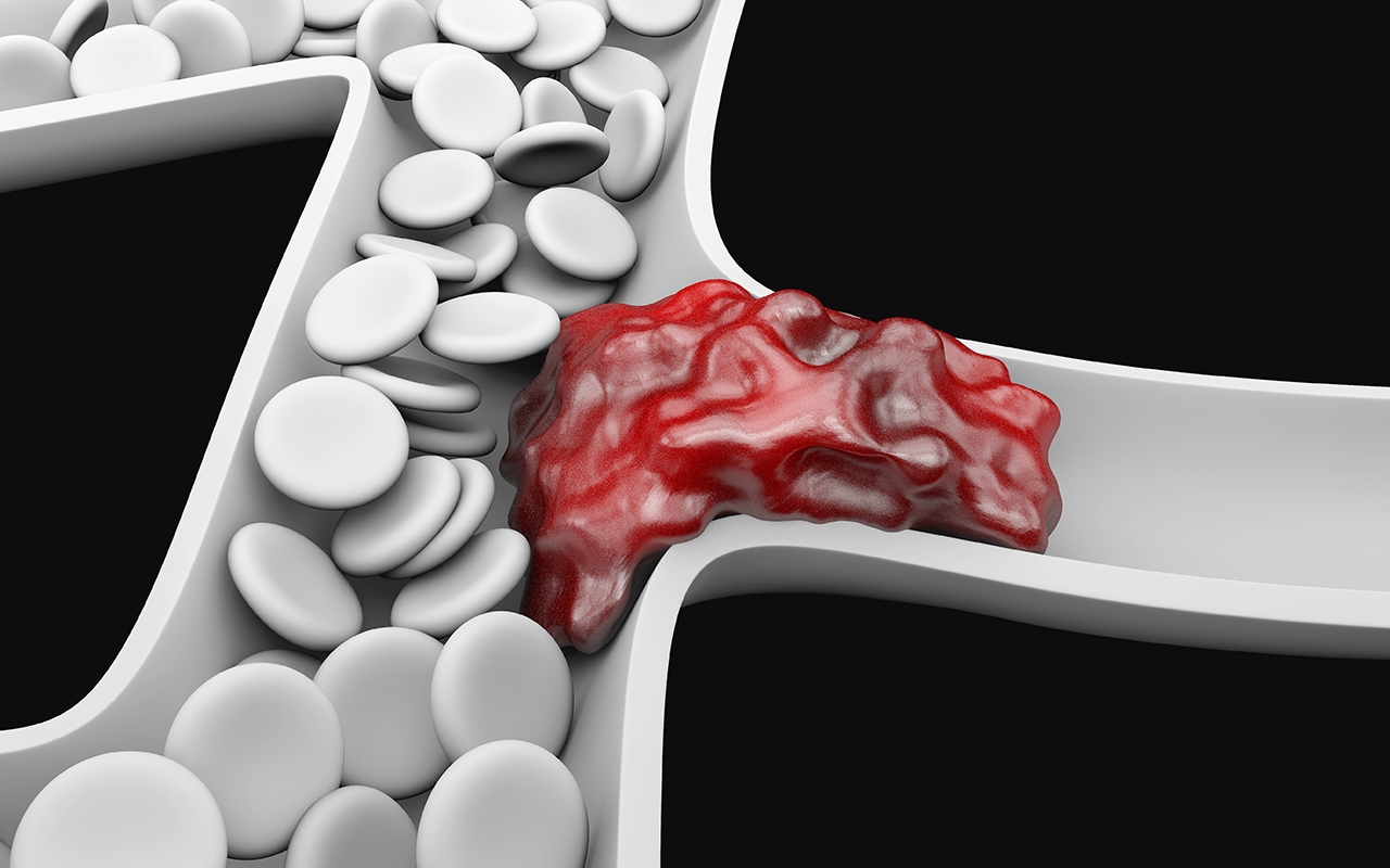 Quiet revolution in treatment of venous thromboembolism 895