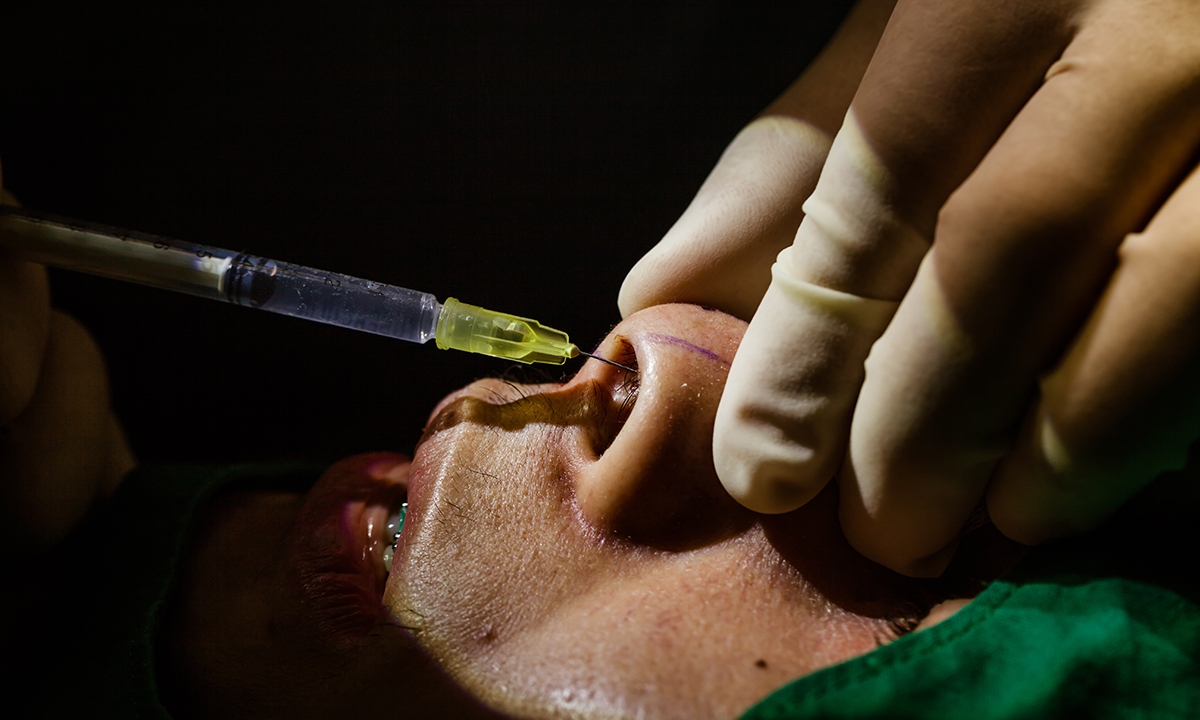 Rhinoplasty: consider mental health before operating - Featured Image