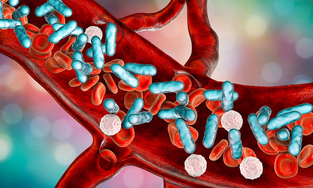 Sepsis time for doctors to get their house in order 271
