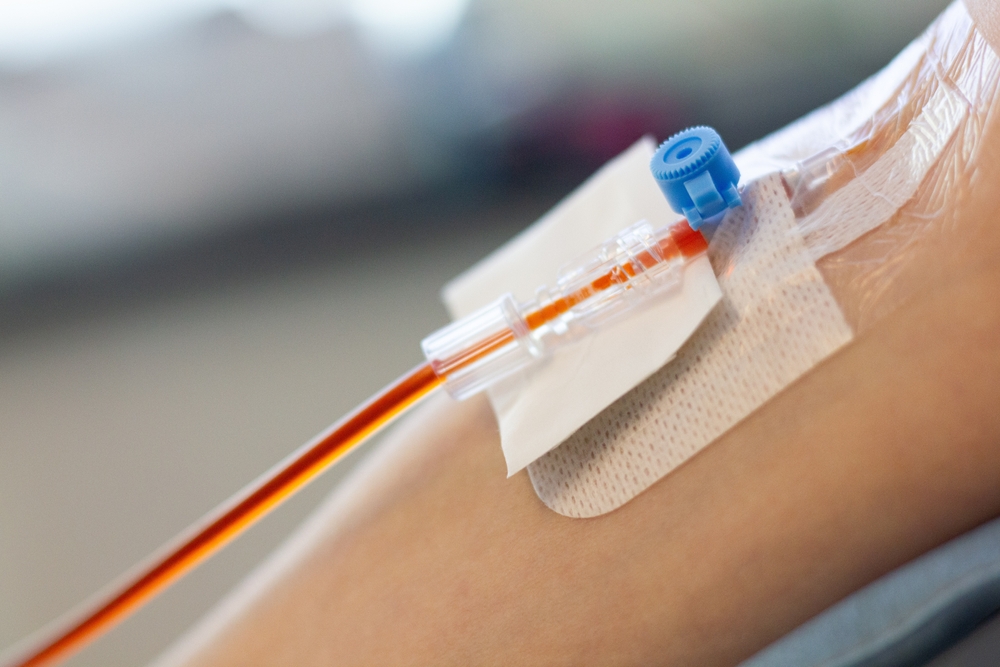 Iron deficiency iron infusion