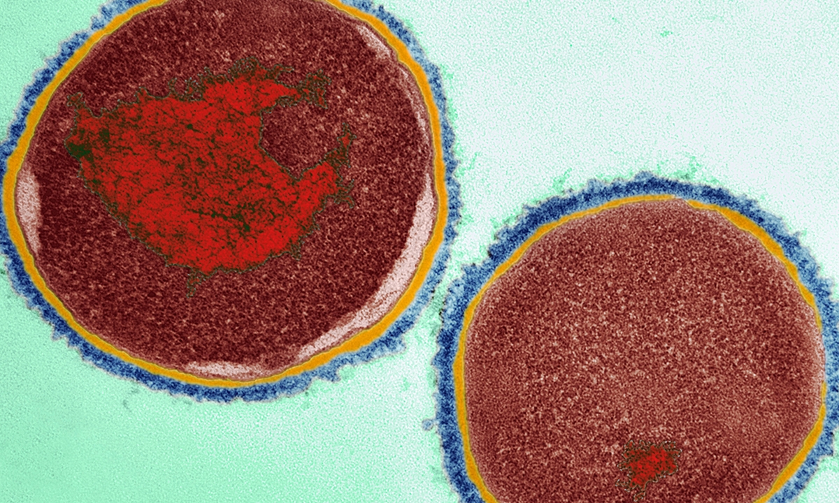 Skin sores in Indigenous children “normalised” - Featured Image
