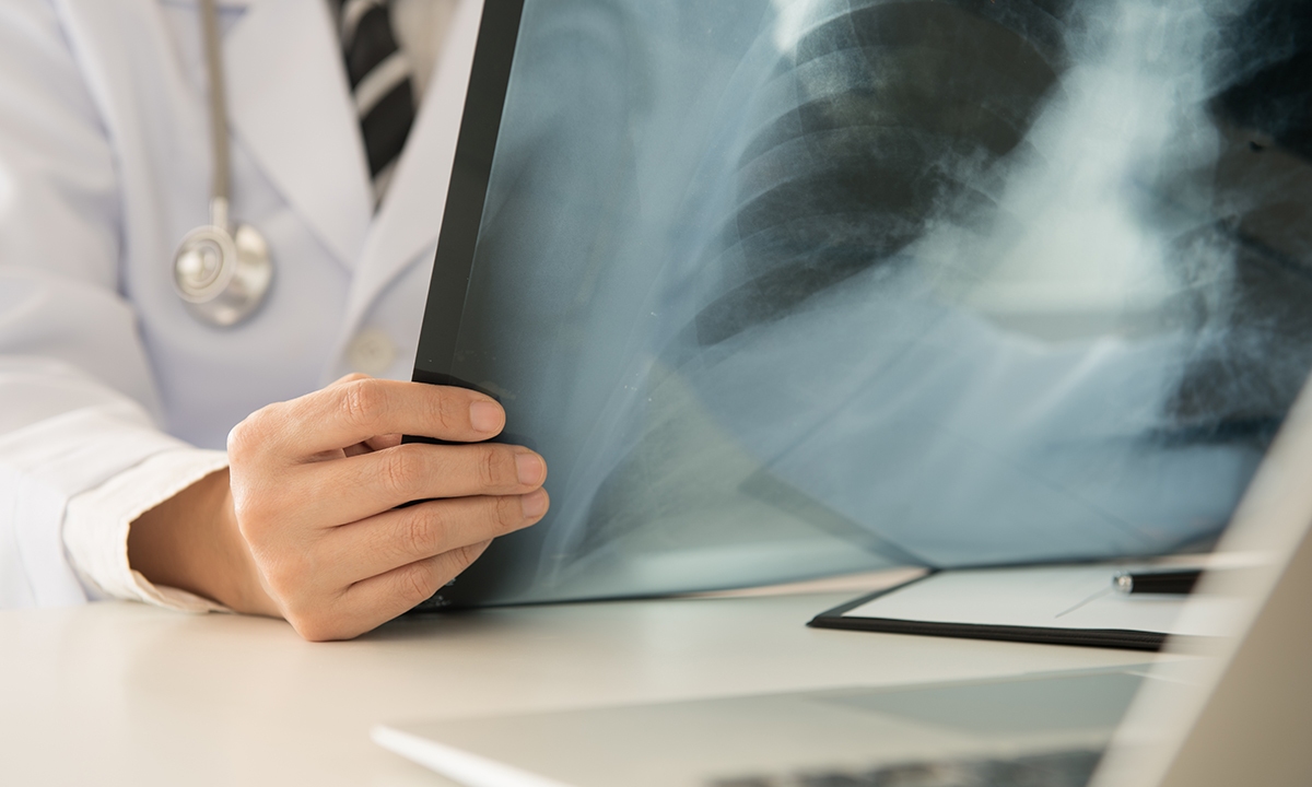 Smoker guilt and stigma delays help seeking 104