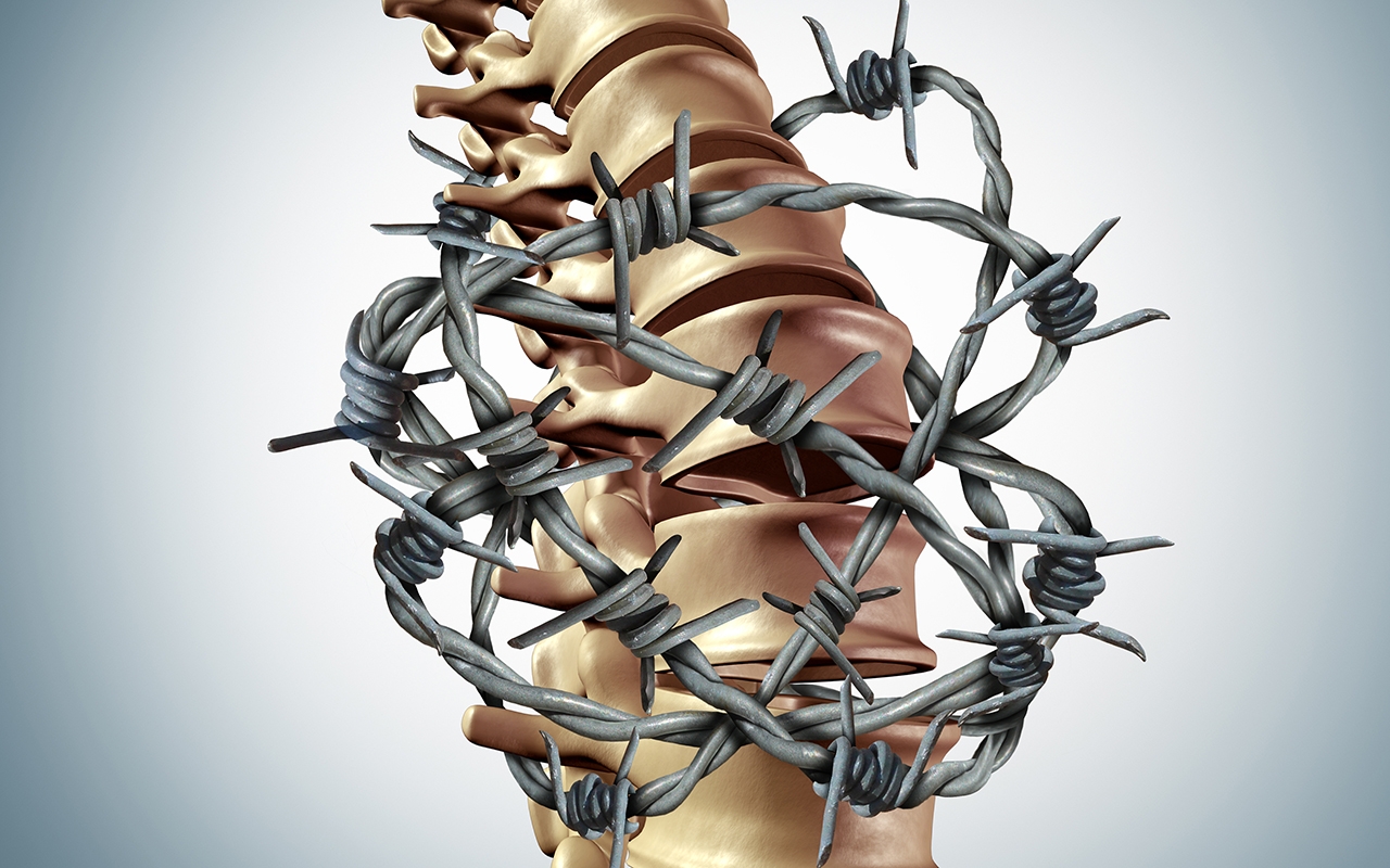 Spinal fusion for low back pain patient selection key 505