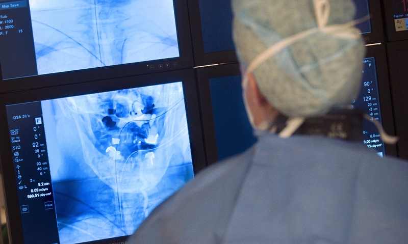 Stroke “revolution” challenges - Featured Image