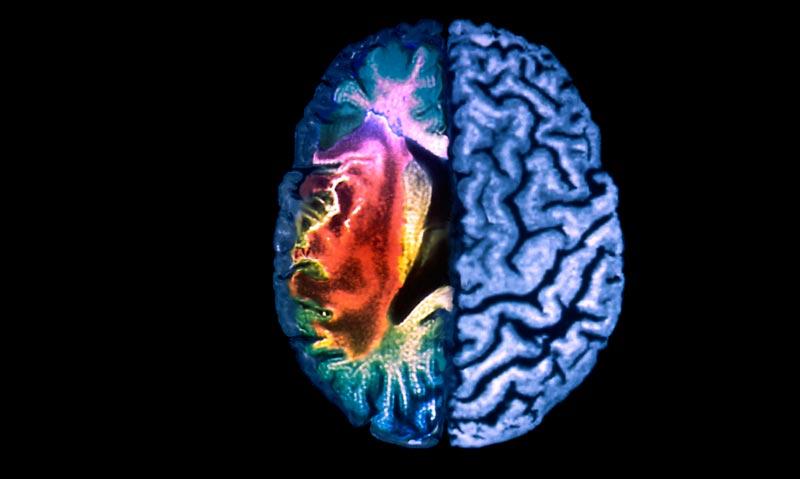 Thrombolysis review controversy - Featured Image