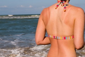 Sunburn large