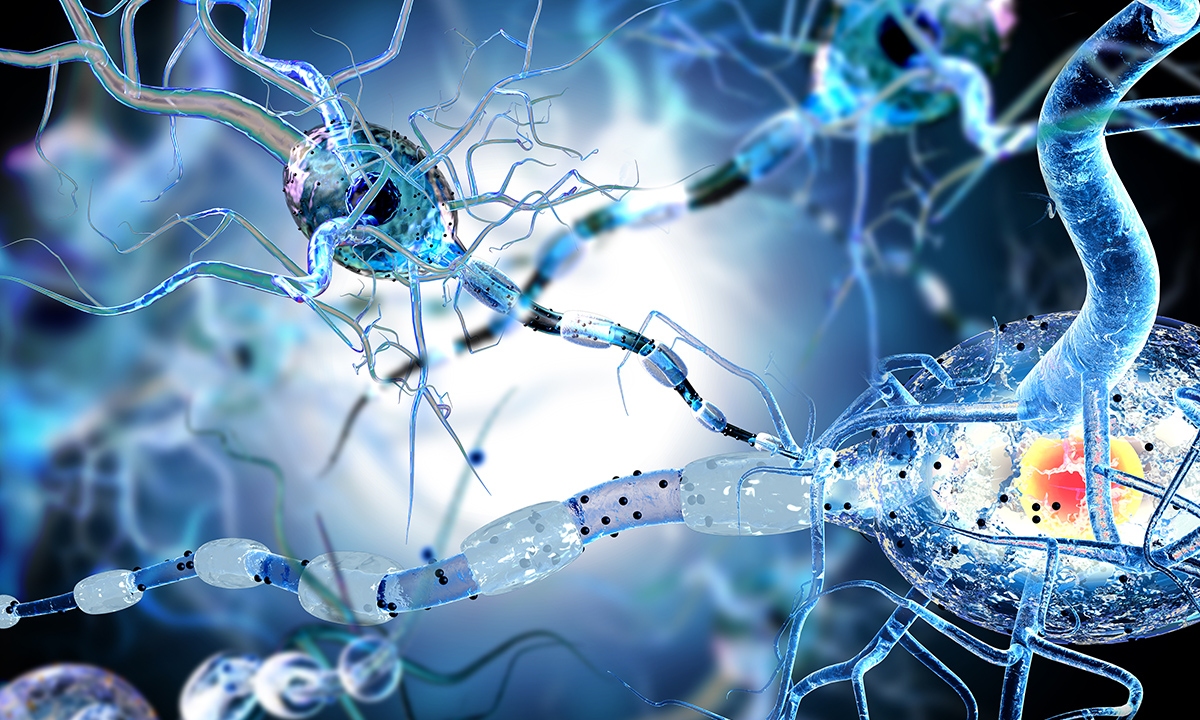 Surgery, precision medicine: the big hopes for epilepsy - Featured Image