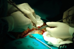 Surgery large