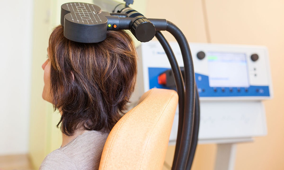 Transcranial magnetic stimulation time for a medicare item number 123