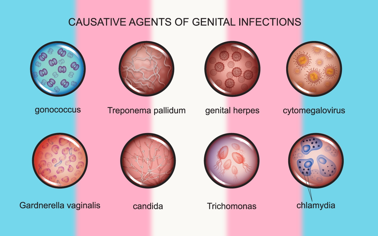 Transgender people “invisible” in health datasets - Featured Image
