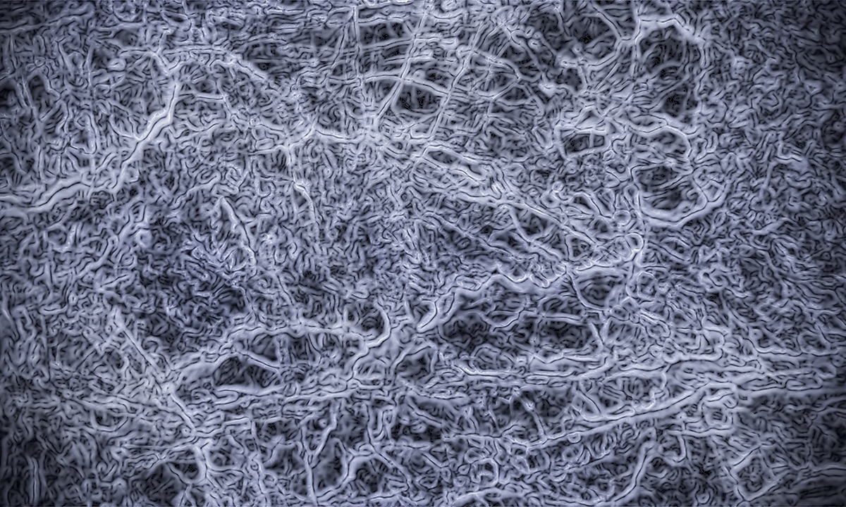 Translating our microbiome 881