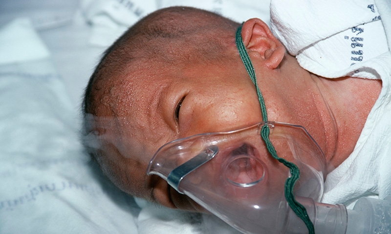 TB incidence “ominous” - Featured Image