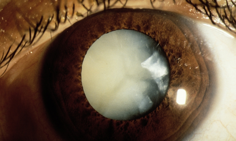 Push to close vision gap - Featured Image