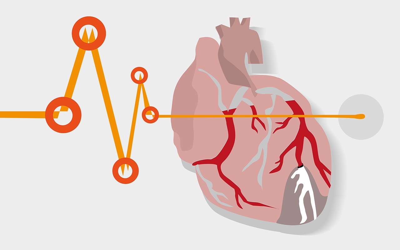 Work to be done to improve heart attack survival rates - Featured Image