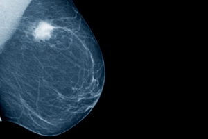 Xray large