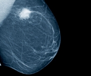 Xray medium