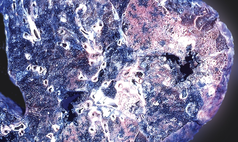 16 00357