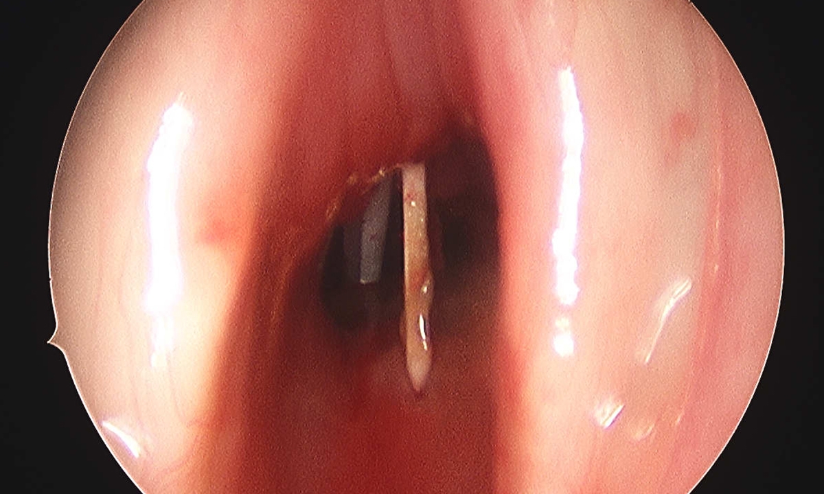 16 00561