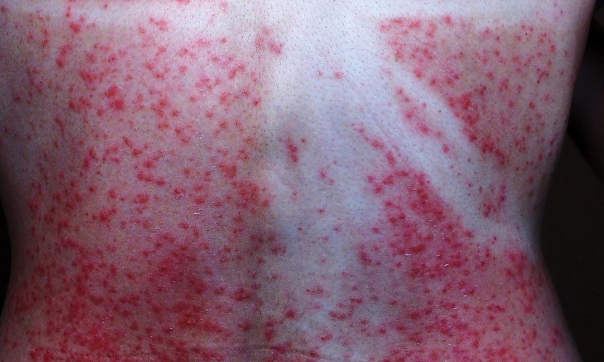 17 00108