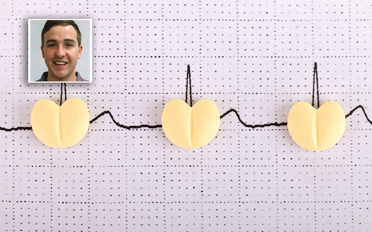 NOACs in rural settings, with Dr Jamie Bellinge
