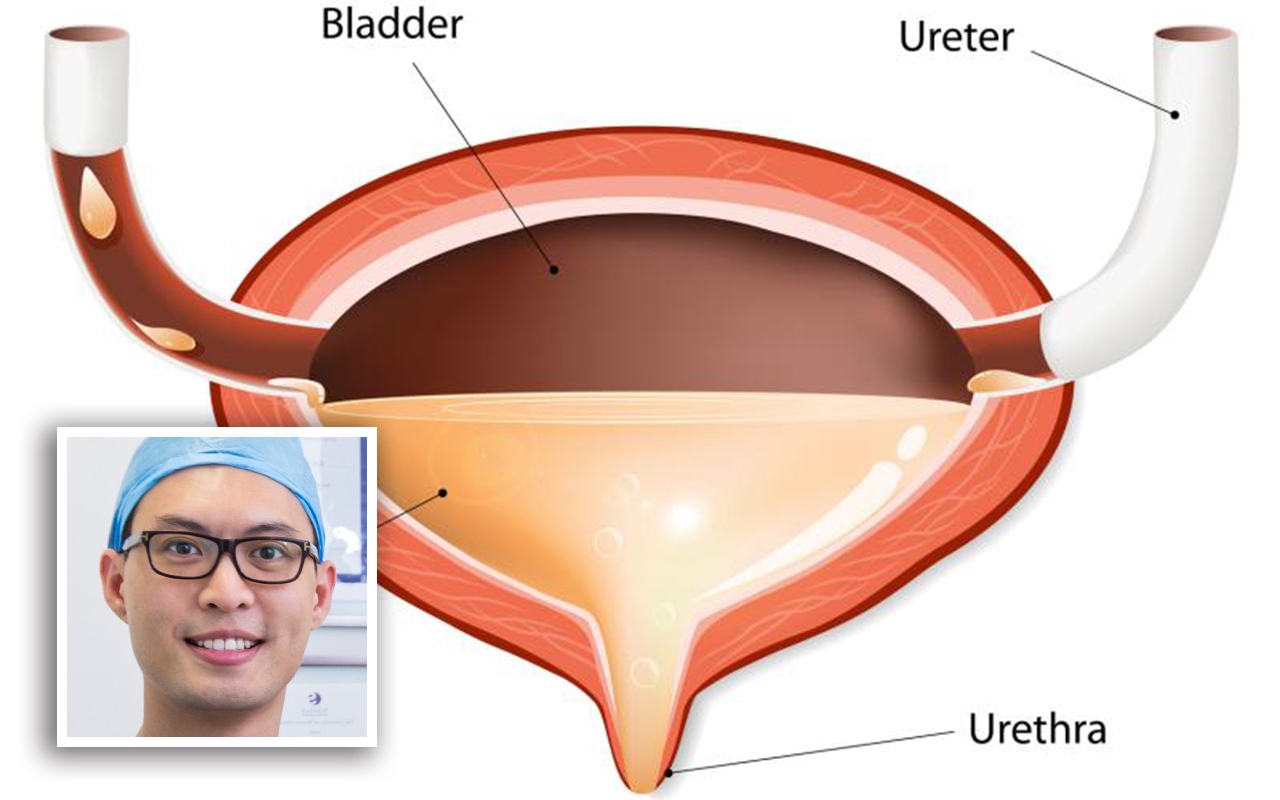 Overactive bladder, with A/Prof Eric Chung