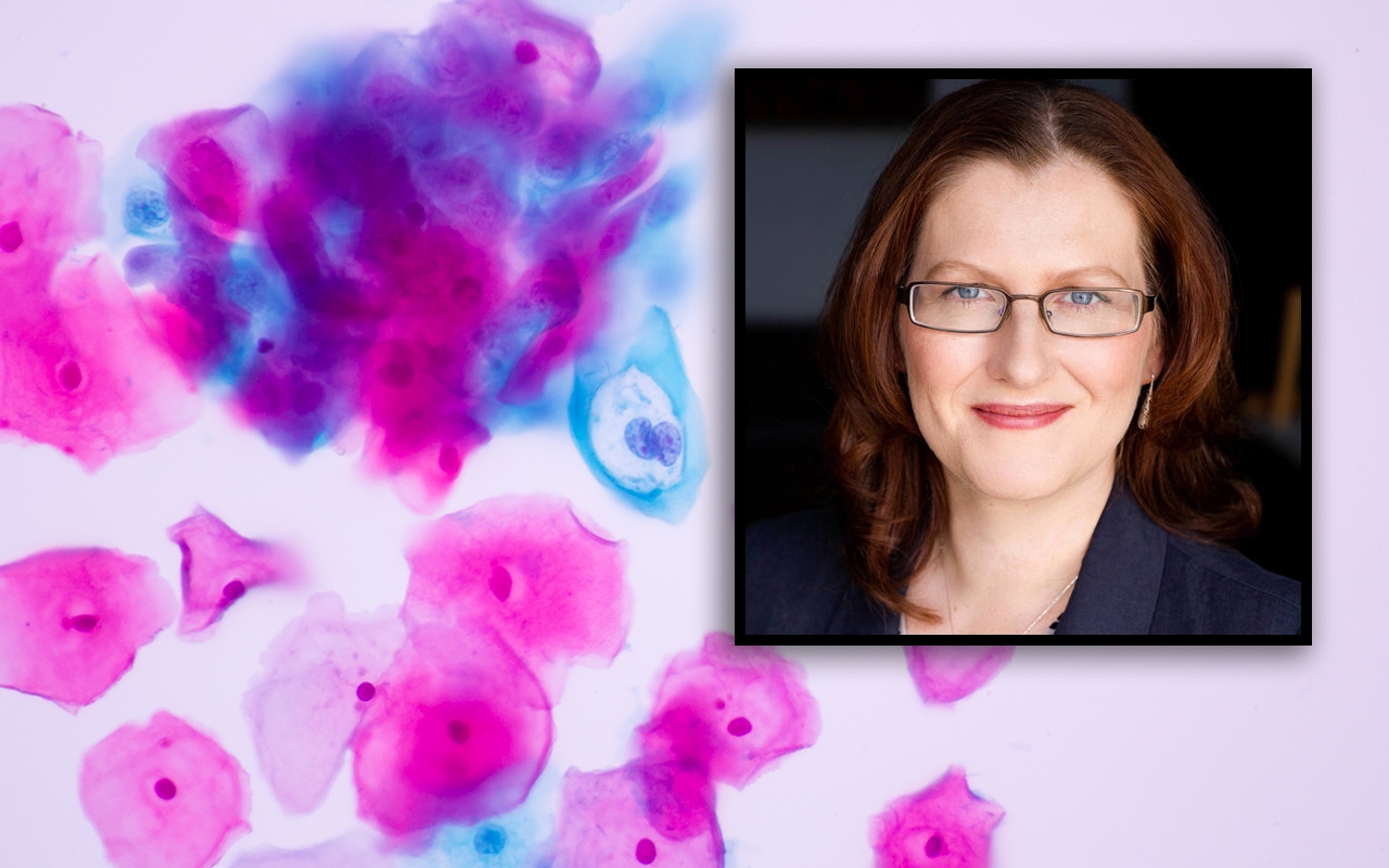HPV vaccination coverage in Indigenous teens, with A/Prof Julia Brotherton