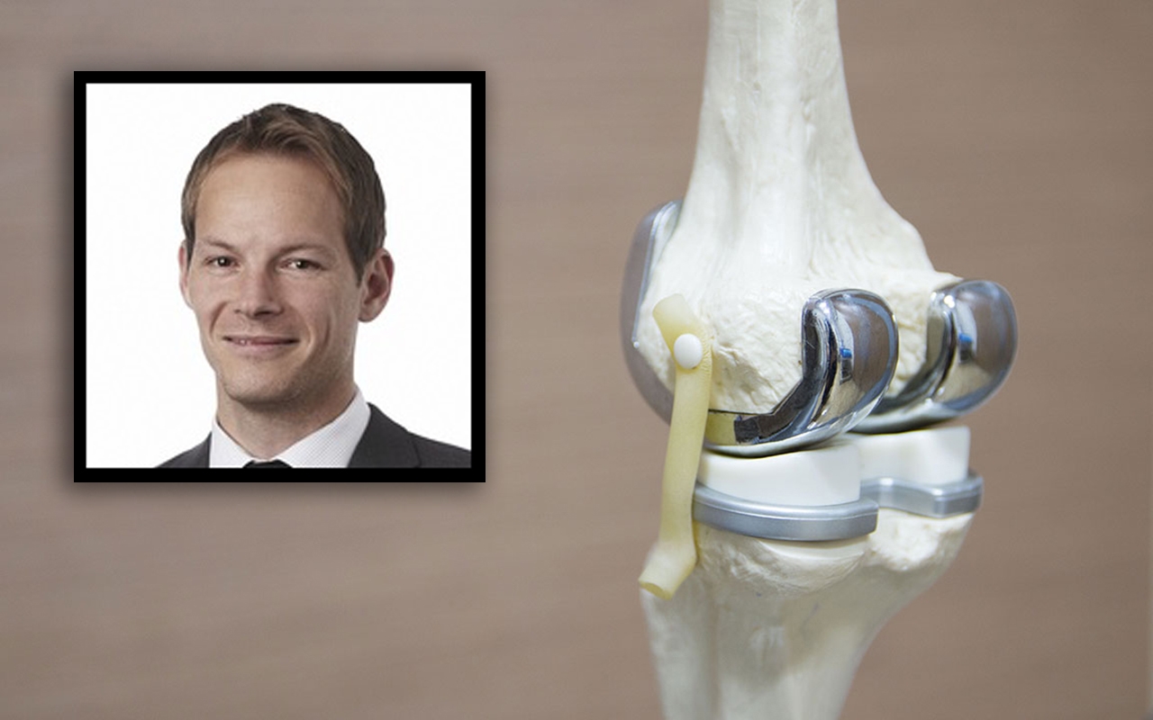 Knee replacement20podcast