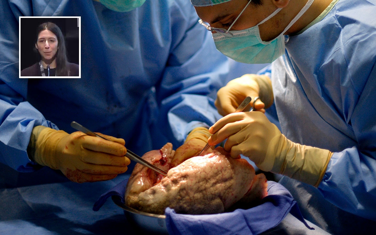 Lung transplantation in Australia, with Dr Miranda Paraskeva