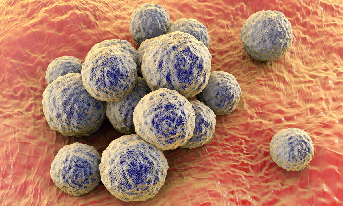MRSA, with A/Prof John Ferguson, and Dr Jason Agostino
