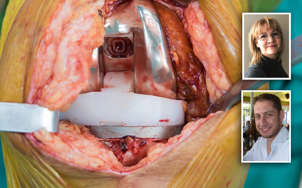 Total knee arthroplasty, with A/Prof Justine Naylor and Dr Sam Adie