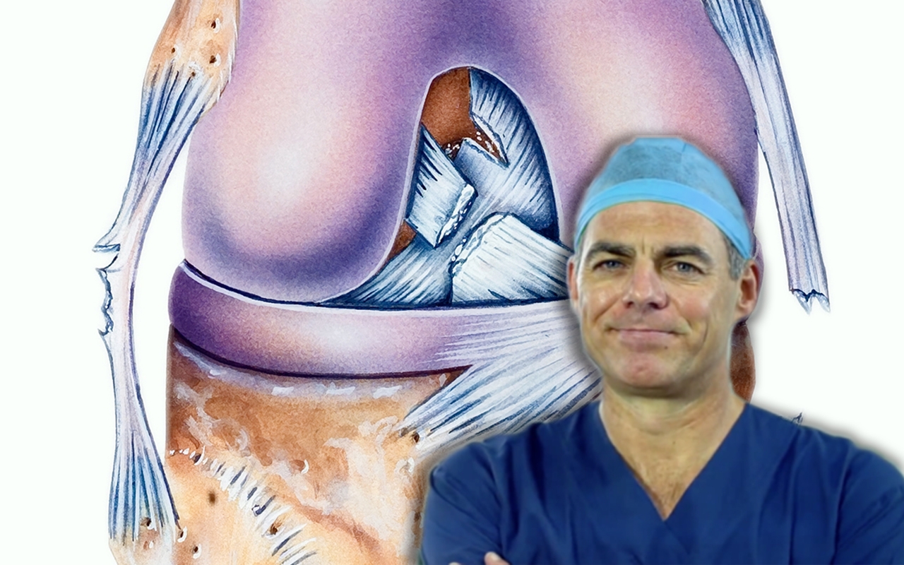 Epidemic of ACL reconstructions in young Australians, with Prof Chris Vertullo