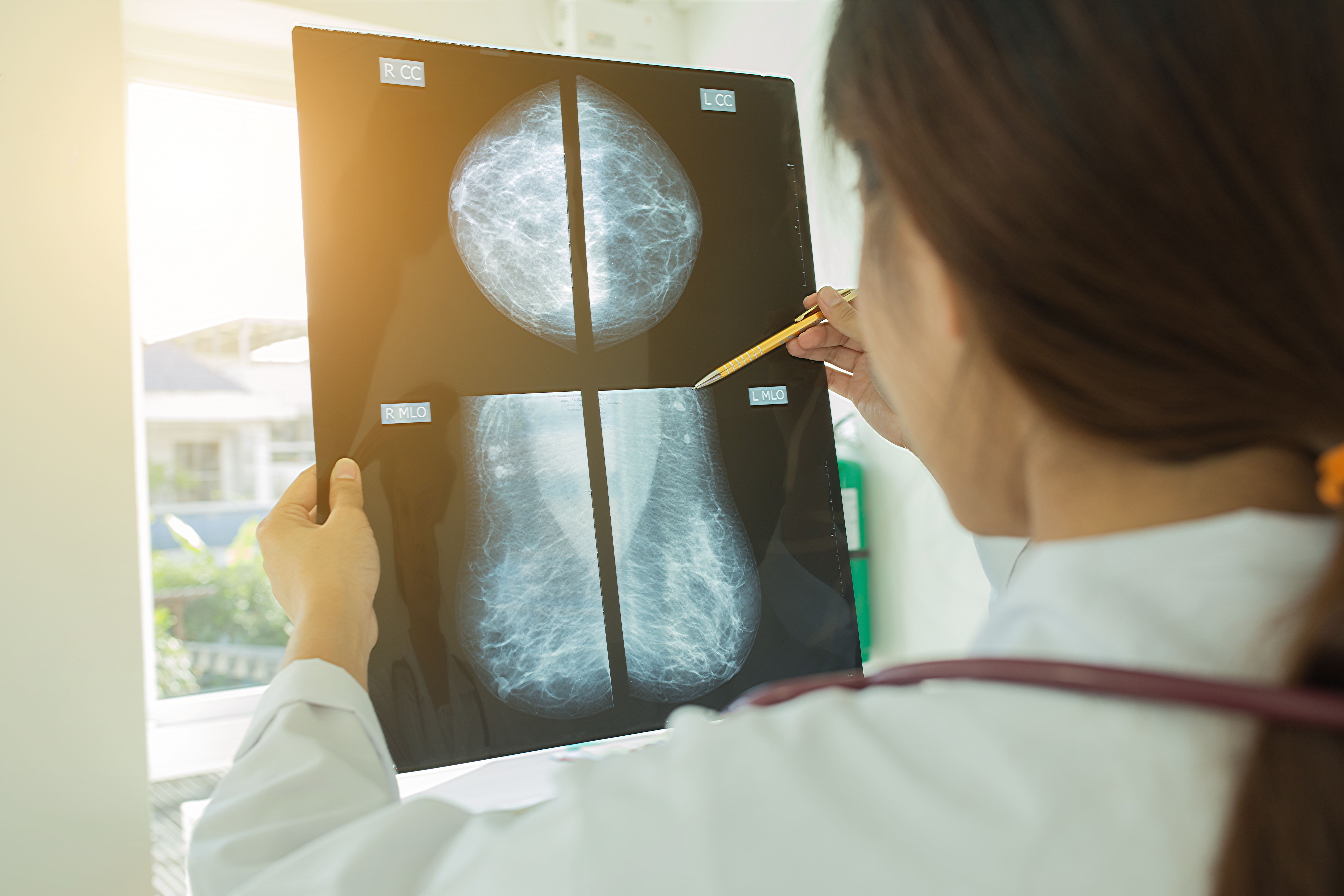 Advances in breast cancer treatment, with Dr Negin Sedaghat and A/Prof. Jeremy Hsu