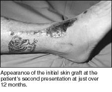 Image of patient's leg