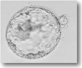 Embryo