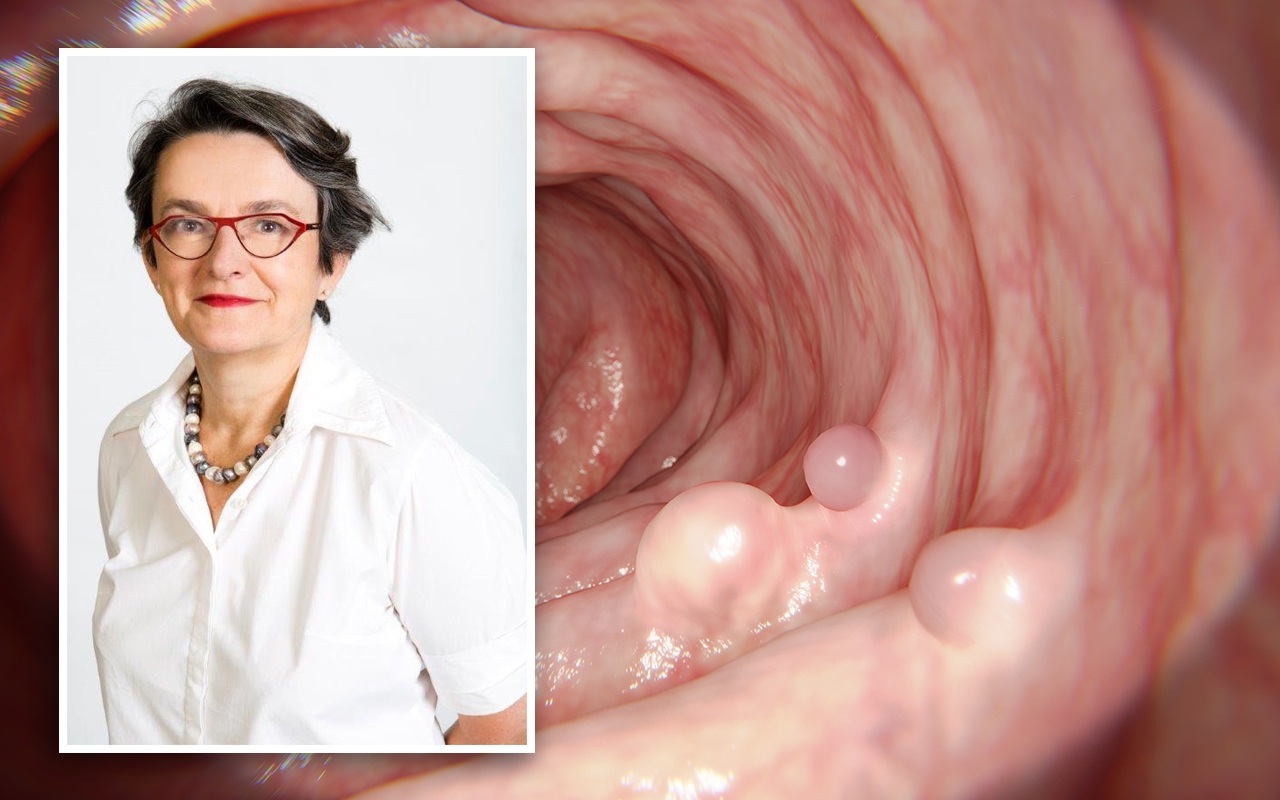 Colonoscopy Clinical Care Standard, with Dr Anne Duggan