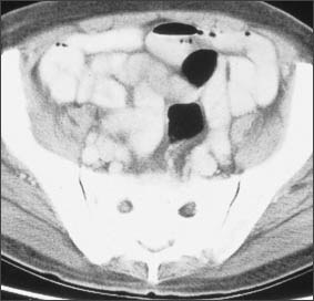 X-ray image