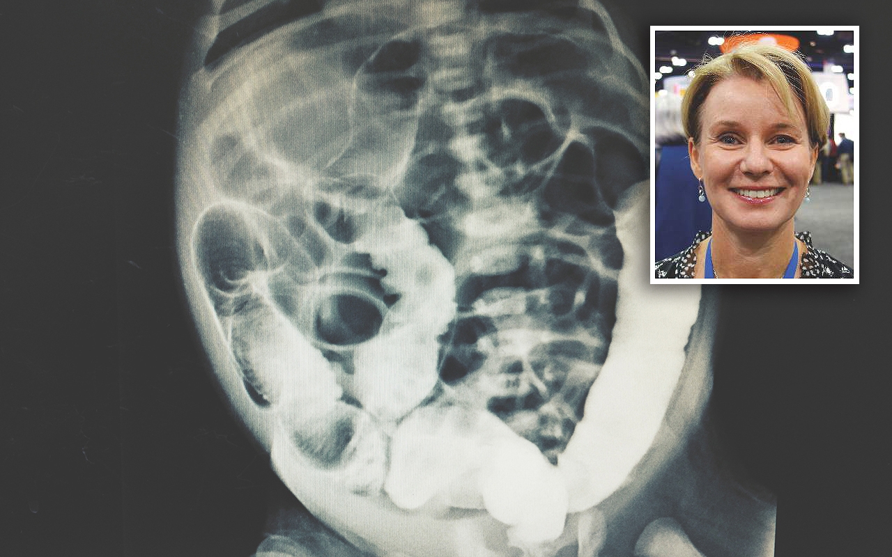 Food protein-induced enterocolitis syndrome, with Prof Dianne Campbell