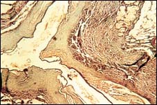 Popliteal artery